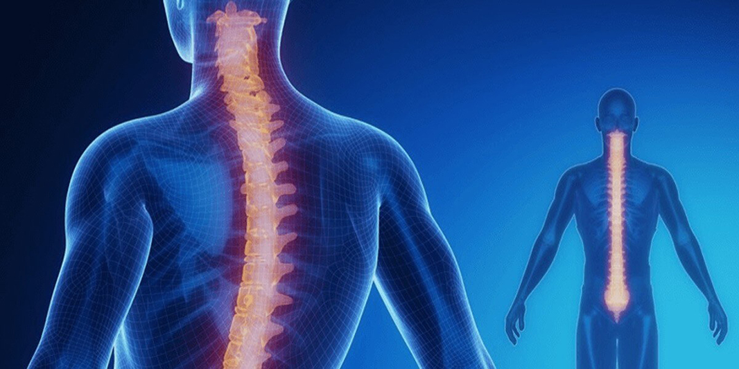 Schroth Terapi (skolyoz) 